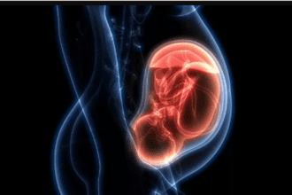Preeclampsia. Foto: Especial.
