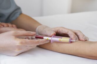 El Alzheimer será diagnosticado mediante una muestra de sangre, revelan los avances médicos