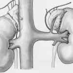 Imagen ilustrativa de un par de riñones. Foto: JLMNoticias / Europeana / Unslpash.