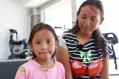 Nueva prótesis cambia la vida de María Guadalupe en Asientos