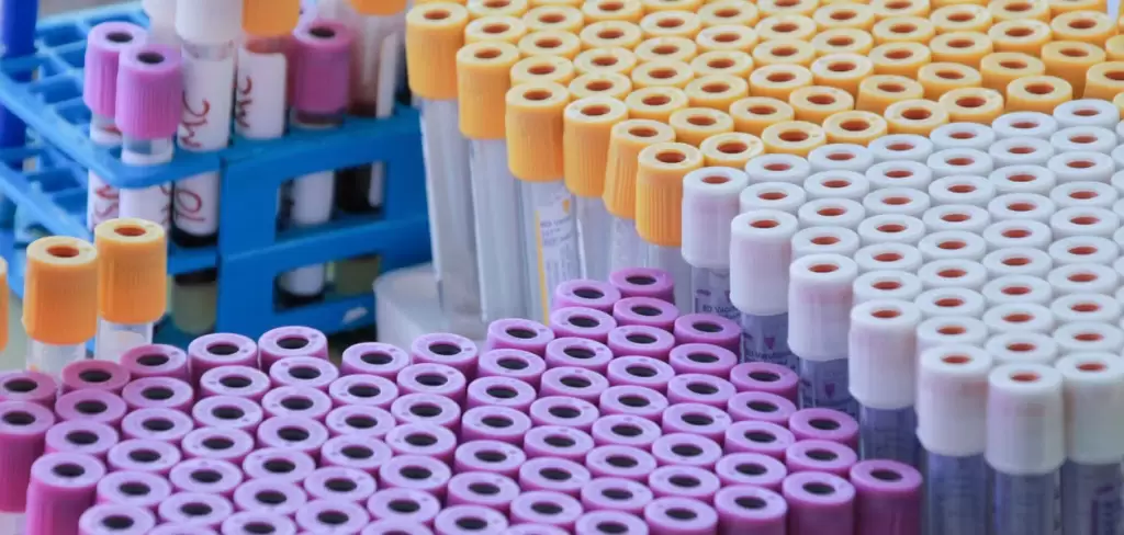 UAA busca frenar el dano renal de la diabetes con debida de agave